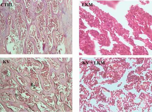 Figure 2. Photomicrograph showing the Influence of kolaviron on bone marrow architecture of benzene-induced leukemia in wistar rats.