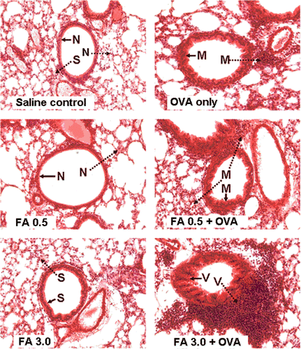 Figure 3.  Histopathology for lung inflammation (tissue cell infiltration) and airway remodeling. Lung tissue was fixed, stained with H&E, and sectioned in 10-µm slices. →: Bronchial remodeling – –▸: lung tissue cell infiltration; N: normal conditions; S: slight changes;M: moderate changes; V: severe changes. Magnification = 20X.