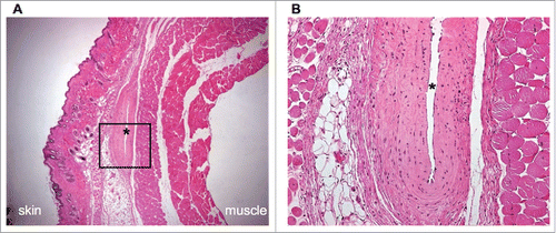 Figure 2. Histological assessment of the prevascularized subcutaneous device-less site. (A) Hematoxylin and eosin staining illustrating the cross-section of collapse vascularized collagen lumen subsequent to catheter withdrawal (100x), (B) insert (200x). * Indicates lumen of DL transplant site.