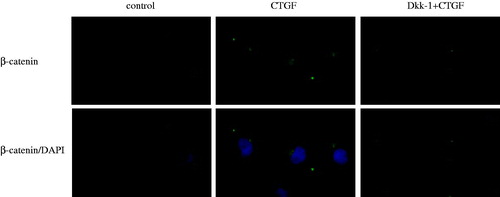 Figure 2. Effects of CTGF and Dkk-1 on β-catenin in HK-2 cells were showed by immunofluorescence staining (original magnification ×400). Left: normal control; middle: HK-2 cells were treated with CTGF (50 ng/mL) for 24 h; right: HK-2 cells were pretreated with Dkk-1 (200 ng/mL) for 1 h and then treated with CTGF (50 ng/mL) for 24 h. β-catenin expression is shown in green and cell nucleuses are shown in blue.