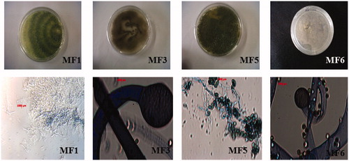Figure 1. The morphology (colony appearance, fruiting structures and spores) of identified endophytic fungi isolated from the leaves of Markhamia tomentosa.