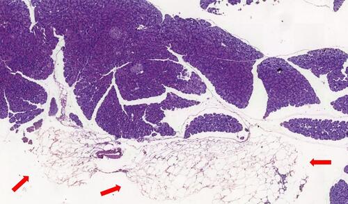 Figure 7 ob/ob trained mouse pancreas with visceral fat adjacent (arrow) to pancreatic parenchyma with no signs of lobular infiltration (original magnification ×5).