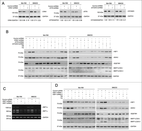 Figure 7. XBP1 plays an important role in RIPK1 upregulation in melanoma cells upon ER stress. (A) Whole cell lysates from Mel-RM and MM200 cells transduced with the control, ERN1, ATF6, or EIF2AK3 shRNA were subjected to western blot analysis of ERN1 (left panel), ATF6 (middle panel) or EIF2AK3 (right panel) and GAPDH (as a loading control). The numbers represent knockdown efficiencies. The data shown are representative of 3 individual western blot analyses. (B) Mel-RM and MM200 cells transduced with the control, ERN1, ATF6, or EIF2AK3 shRNA were treated with tunicamcyin (TM) (3 μM) or thapsigargin (TG) (1 μM) for 16 h. Whole cell lysates were subjected to western blot analysis of HSF1, RIPK1, SQSTM1, MAP1LC3A, and GAPDH (as a loading control). The data shown are representative of 3 individual experiments. (C) Mel-RM and MM200 cells transfected with the control or XBP1 siRNA were subjected to RT-PCR for the analysis of XBP1 mRNA. GAPDH was used as a loading control. The data shown are representative of 3 individual qPCR analyses. (D) Mel-RM and MM200 cells transfected with the control or XBP1 siRNA were treated with TM (3 μM) or TG (1 μM) for 16 h. Whole cell lysates were subjected to western blot analysis of HSF1, RIPK1, SQSTM1, MAP1LC3A, and GAPDH (as a loading control). The data shown are representative of 3 individual experiments.