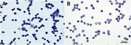 Figure 1. Morphological observation of isolated PBMCs and PMNLs from dry cows. (A) PBMCs were mainly lymphocytes (black arrow), with some monocytes (white arrow). (B) PMNLs were mainly neutrophils (white arrow), with some eosinophils (black arrow). PBMCs: Peripheral blood mononuclear cells; PMNLs: Polymorphonuclear leukocytes.