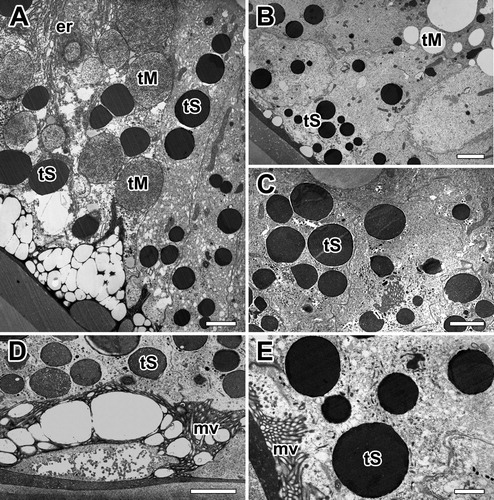 Figure 3. Electron micrographs of the major ampullate gland in A. cavaticus during intermolt period. A, B: Two types of secretory granules appeared. Type-S granules (tS) are seen at the apical region and Type-M granules (tM) are near the base of epithelial cells. C: Type-S granules which have electron-dense fine granular appearance are seen during the intermolt period. D: As Type-M granules flows toward the funnel, it is coated with secretion of Type-S granules. E: Type-S granules have a similar structure regardless of size. er: rough endoplasmic reticulum, mv: microvilli. Scale bars = 0.5 µm (A, B) and 0.2 µm (C-E), respectively.