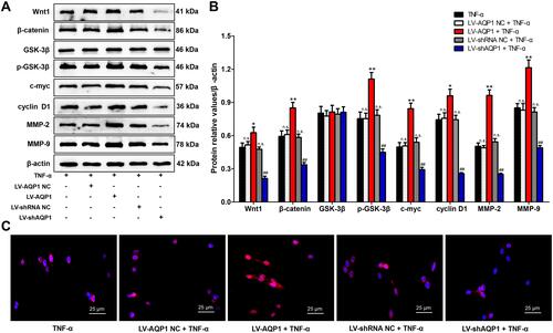 Figure 5 Effects of AQP1 overexpression or silencing on Wnt/β-catenin signaling pathway in TNF-α-stimulated MH7A cells. (A) Typical examples of protein expressions of Wnt/β-catenin pathway key members and the target genes from various groups, detected by Western blot. (B) Quantitative statistical results of protein relative values, β-actin served as the housekeeping protein. (C) Typical photos of β-catenin nuclear translocation from various groups (×200). Immunofluorescence staining was carried out to make β-catenin (red) visible and DAPI was used to stain the cell nuclei (blue). The data are mean ± SEM of three independent experiments performed in triplicate. n.s. compared with non-transfected control group. *P < 0.05, **P < 0.01 compared with LV-AQP1 NC group. ##P < 0.01 compared with LV-shRNA NC group.