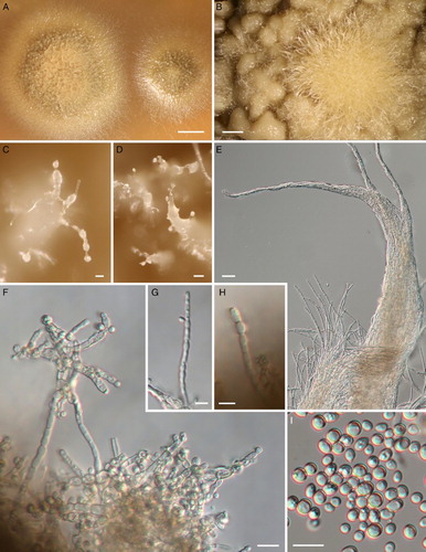 Figure 9. Chaenothecopsis schefflerae in culture (ICMP 21683) isolated from specimen PDD110730. A, Three-month-old colonies on malt extract agar. B, Detail of colony surface. C–D, Conidiophores and conidia. E, Bundles of aerial hyphae. F, Conidiophores. G–H, Chlamydospores. I, Conidia. Scale bars 2 mm (A), 1 mm (B), 50 µm (D) 20 µm, (E–F), 10 µm (C, G, H, I).