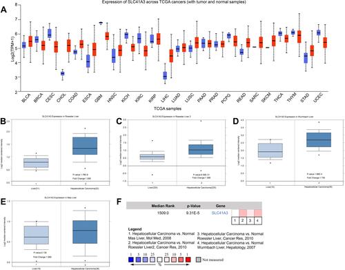 Figure 1 Expression of SLC41A3 mRNA in HCC and normal tissues. (A) The expression of SLC41A3 mRNA in various cancers based on the TCGA database (UALCAN). (B–E) Box plot showing SLC41A3 mRNA levels in the Roessler Liver, Roessler Liver 2, Wurmbach Liver, and Mas Liver datasets, respectively (Oncomine). (F) Comparison of SLC41A3 mRNA level across 4 analyses showed a significant difference between HCC and normal tissues.