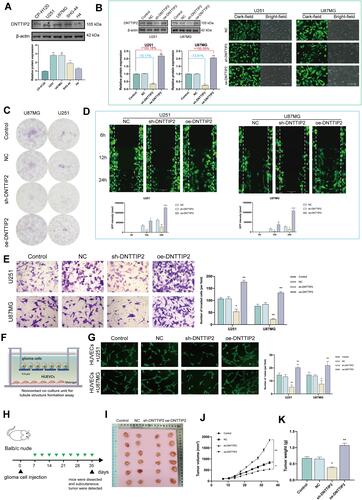 Figure 4 DNTTIP2 overexpression promotes a malignant phenotype in glioma. (A) DNTTIP2 protein expression in normal human glioma cells. (B) The transfection efficiency was verified by the GFP expression as well as the Western blot. Transfection efficiency is represented as percentages. (C) Clone formation ability of the glioma cells transfected with the NC, sh- DNTTIP2, and oe‐DNTTIP2. (D) Cell scratch migration assay of the migratory ability of each group of glioma cells. (E) Cell invasion was determined via a Transwell assay. (F) Illustration of the model for Tube formation assay. (G) Tubule formation of HUVECs and column graph of tubule formation index in different groups. (H) Schematic diagram of subcutaneous tumor models. (I) Xenograft mouse tumors (n= 6 mice per group). (J and K) Volumes (J) of xenograft tumors measured twice a week and weights (K) of xenograft tumors at completion of the study. Data are means ± SEM *p < 0.05; **p <0.01; ***p < 0.001; ****p < 0.001.