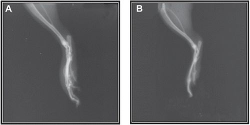 Figure 3.  Radiographs of the adjuvant injected paw (Day 49). (A) Control, (B) PE-treated.