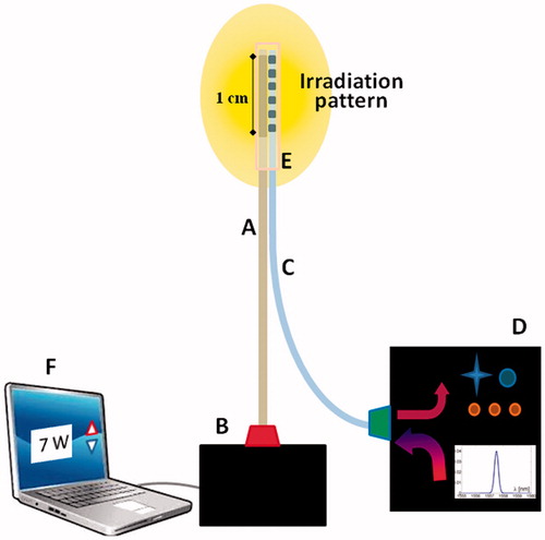 Figure 1. Schematic of laser delivery and of temperature measuring systems. These include the delivery fibre which guides the high-power laser beam (A) emitted by means of a diode-based laser source (B) to the 1 cm emitting area (drawing not in scale), the temperature fibre Bragg grating sensor (C), and the optical interrogator (D). The tips of the delivery fibre and of the FBG are bound together by a glass capillary (E). A laptop (F) is used to control the laser system.