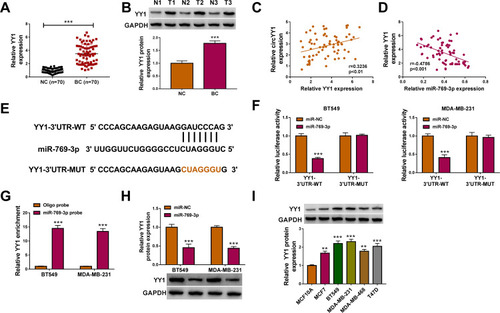 Figure 5 YY1 served as a target for miR-769-3p in BC cells. (A and B) QRT-PCR and Western blotting were carried out to analyze the expression of YY1 mRNA and protein in BC tissues and neighboring normal tissues. (C and D) Correlation of YY1 mRNA and circYY1 or miR-769-3p expression in BC tissues was assessed by Pearson’s correlation analysis. (E) Prediction of the binding sites between miR-769-3p and YY1 by the TargetScan database. (F) Relative luciferase activities were investigated in BT549 and MDA-MB-231 cells co-transfected with miR-769-3p mimic or miR-NC and YY1-3ʹUTR-WT luciferase reporter or YY1-3ʹUTR-MUT luciferase reporter. (G) RNA pull-down assay revealed the enrichment of YY1 mRNA in the miR-769-3p probe group and Oligo probe group. (H) Western blotting showed the protein level of YY1 in BT549 and MDA-MB-231 cells transfected with miR-769-3p mimic or miR-NC. (I) Western blotting revealed the level of YY1 protein in BC cells. **P < 0.01 and ***P < 0.001.