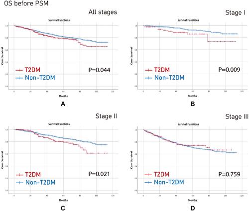 Figure 2 OS before PSM. (A) All stages; (B) Stage I; (C) Stage II; (D) Stage III.