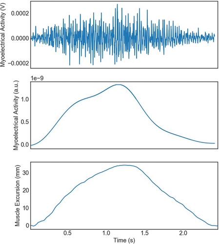 Figure 5. Raw quadriceps contraction data output from a parallel squat sEMG (top), filtered sEMG (middle) used for data analysis comparison to raw sMMG (bottom).