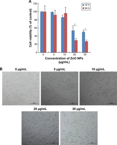 Figure 2 Effects of ZnO NPs on cell viability and cell morphology.Notes: SKOV3 cells were incubated with different concentrations of ZnO NPs for 12 and 24 h, and then the viability of SKOV3 cells was determined using WST-8 assay. (A) The results are expressed as the mean ± standard deviation of three independent experiments. A significant difference was observed between control and treated cells. The viability of treated cells was compared to that of the untreated cells using Student’s t-test (*P<0.05). (B) Phase contrast microscopy data showing the morphologic appearance of SKOV3 cells after treatment with ZnO NPs for 12 h. Scale bars =200 μm.Abbreviation: ZnO NPs, zinc oxide nanoparticles.