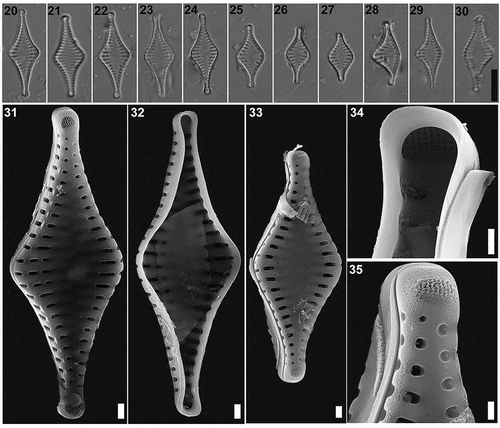 Figs 20–35. Pseudostaurosira australopatagonica sp. nov., population from Lago Cipreses, Chile. Figs 20–30. LM images of valve views. Figs 28–30. Teratological forms. Figs 31–35. SEM images. Fig. 31, 33. External valve view. Fig. 32. Internal valve view. Fig. 34. Detail of the apical pore field, internal view. Fig. 35. Detail of the apical pore field, external view. Scale bar: Figs 20–30, 10 µm; Figs 31–33, 10 µm; Figs 34–35, 500 nm