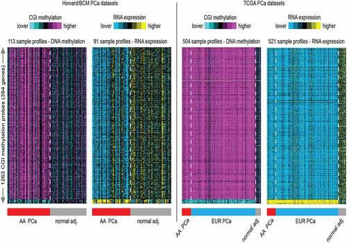 Figure 2. Heat map generated from hierarchical clustering analysis of the top 1263 CGI probes most variable CpG islands across all samples in the genome-wide methylation analysis and correlated with RNA expression profiles. A. The AA dataset consists of 63 PCa and 50 normal adjacent (adj.) prostate tissue DNA used in the methylation analysis and 96 RNA samples (matched PCa and normal adj. tissues) used in the transcription analysis. B. The TCGA methylation dataset consists of 504 prostate tissues used in the genome-wide DNA methylation analysis. This is made up of 58 AA PCa and 3 AA normal prostate tissues, and 412 EUR PCa and 31 EUR normal prostate tissues. The TCGA RNA expression consists of 521 prostate tissue RNA samples. This is made up of from 58 AA PCa and 7 AA normal prostate tissues, and 412 EUR PCa and 44 EUR normal tissues.