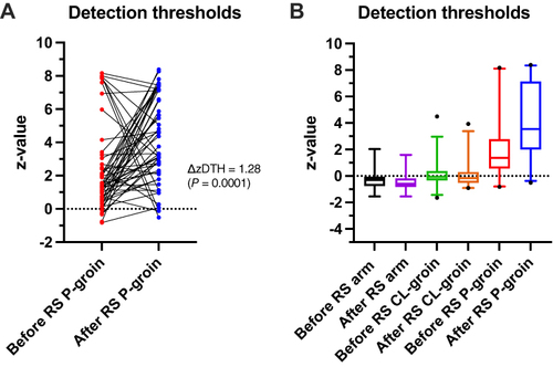Figure 1 Detection Thresholds. The z-scores (zDTH; y-axes) of the mean of the detection thresholds ((MDT + CDT + WDT)/3) before and after re-surgery (RS; x-axes). Reference z-scores are calculated from the contralateral (CL) groin before and after RS. The dot-line diagram (A) illustrates individual zDTH-scores in the painful groin (P-groin) before and after re-surgery (ΔzDTH = 1.28; P = 0.0001; effect size = 0.49). The box-whisker plot (B) illustrates zDTH-scores in the lower arm, in the CL-groin, and in the P-groin before and after re-surgery. Whiskers indicate the 2.5 and 97.5 percentiles. Outliers are indicated. The comparisons of before/after re-surgery data were by Wilcoxon matched-pairs signed-rank tests.