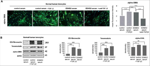 Figure 5. TGF β2 from EDMD2 serum induces fibrosis markers in normal human tenocytes. (A) Immunofluorescence staining of alpha-SMA in normal human tenocytes cultured in the presence of control serum, control serum + TGF β2, EDMD2 serum or EDMD2 serum + anti-TGF β2. Nuclei were counterstained with DAPI. Bar, 20 μm. Quantitative analysis of mean fluorescence intensity of alpha-SMA is reported in the graph. (B) Western blot analysis of ED-fibronectin, tenomodulin and alpha-SMA in control tenocytes exposed to control serum, control serum + TGF β2 or EDMD2 serum. Densitometric analysis of immunoblotted bands is reported in the graphs. Means ± standard deviation are shown in graphs. Statistically significant differences are indicated by an asterisk (p<0.05), double asterisk (p< 0.01) or triple asterisk (p< 0.001).