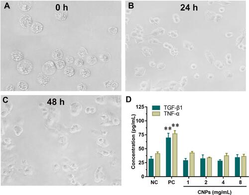 Figure 4 The status of THP-1 cells after PMA induction for (A) 0 h, (B) 24 h, (C) 48 h. (D) The cells were incubated with the RPMI 1640 medium containing 6% phenol (positive control), the cells were incubated with the RPMI 1640 medium (negative control) and the cells were incubated with 1, 2, 4 and 8 mg/mL of CNPs (experimental group). ** P < 0.01, compared with negative control.