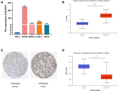 Figure 2 Expression levels of SLFN11 in kidney cancer cell lines and ccRCC tissues and methylation levels in ccRCC tissues. (A) The mRNA expression of SLFN11 was higher in renal cell carcinoma cell lines (ACHN, 786-O, OSRC-2, and Caki-1) than in normal renal tubular epithelial cells (HK-2). (B) SLFN11 protein expression was higher in ccRCC tissues than in normal tissues. (C) Immunohistochemical staining of SLFN11 in ccRCC tissues and normal kidney tissues. (D) SLFN11 is hypermethylated in ccRCC tissues relative to normal tissues. ***p < 0.001.