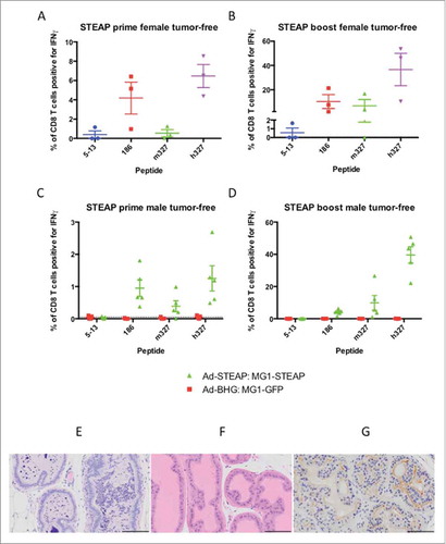 Figure 3. Oncolytic vaccination breaches immune tolerance. Tumor-free female C57BL/6 mice were treated with oncolytic vaccination against STEAP (n = 3) to assess the induction of specific immune responses against known STEAP peptide epitopes as indicated by IFNγ production from CD8+ T cells collected after the prime (A) and boost (B) (mean and SEM displayed). Tumor-free male mice were treated with oncolytic vaccination against STEAP (n = 5) as well as a control group of mice treated with Ad-BHG: MG1-GFP (n = 5). ICS was performed after prime (C) and boost (D) (mean and SEM displayed). Prostatic inflammation was observed following STEAP vaccination (E) (hematoxylin and eosin)- note the heavy pleocelluar luminal infiltrate compared to healthy prostatic tissue (F) (hematoxylin and eosin). Luminal epithelial STEAP expression was confirmed immunohistochemically in the healthy prostate (G) (DAB substrate chromogen and hematoxylin counterstain) (scale bars = 100 μm).