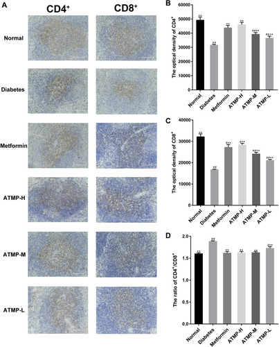 Figure 7 Effects of ATMP on the expression of CD4+ and CD8+ by immunohistochemistry in spleens. Representative images of CD4+ and CD8+ for normal, diabetes, metformin, ATMP-H, ATMP-M and ATMP-L groups in the left panel and quantitative analysis correspondingly in the right panel. (A) Image of CD4+ and CD8+ (magnification 200 ×). (B) The optical density of CD4+. (C) The optical density of CD8+. (D) CD4+/CD8+ ratio in spleens. Data were presented as the mean ± SEM, n=6 per group. **P < 0.01 vs diabetes group. #P < 0.05; ##P <0.01 vs normal group.