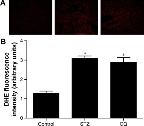 Figure 6 Effects of CQ on myocardial ROS levels in STZ-induced mice.