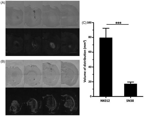 Figure 2. Evaluation of distribution of NK012 in normal rats. (A and B) Distributions of free SN-38 (A) and NK012 (B) (0.2 mg/ml; 20 μl) infused by CED into the striatum of rat brains. Animals were euthanized immediately after infusion and serial sections were obtained using a cryostat (20 μm thickness; 1 mm interval). Bright-field images reveal the brain tissue (upper row), and the same sections visualized with a fluorescence microscope detect the fluorescence generated from SN-38 under ultraviolet radiation (lower row). Serial images obtained from representative rats are shown. (C) Mean volumes of distribution after infusion of NK012 and free SN-38. Columns show mean of determinations; bars, SD. ***p < 0.001.