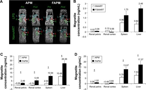 Figure 4 (A) 3D gradient recalled echo images of the same mouse before (pre) and 24 hours after (post) injection of APM or FAPM; (B) SMART and FSMART biodistribution measured by MRI; APM and FAPM biodistribution in renal pelvis, renal cortex, spleen, and liver, quantified by T2 MRI images in (C) LPS or (D) nanoATV/r treated mice.Notes: Data are presented as mean ± SEM, *P<0.05 considered significant using Student’s t-test.Abbreviations: L, liver; S, spleen; K, kidney; APM, ALN-PEG-coated magnetite; FAPM, ALN-PEG-FA-coated magnetite; SMART, small magnetite antiretroviral therapy; FSMART, folic acid-coated SMART; MRI, magnetic resonance imaging; LPS, lipopolysaccharide; nanoATV/r, nanoformulated ritonavir (RTV)-boosted atazanavir (ATV); nanoART, nanoformulated antiretroviral therapy; ALN, alendronate; PEG, polyethylene glycol; FA, folic acid.