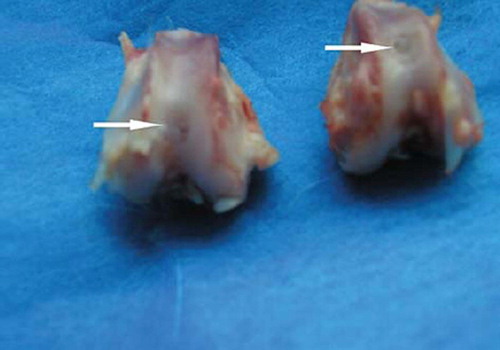 Figure 1. Gross observation of bone marrow MSCs group 12 weeks postoperatively.