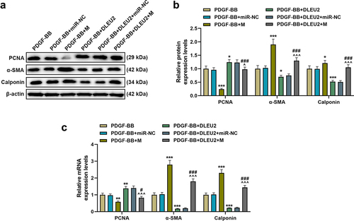 Figure 4. The effects of lncRNA DLEU2 and miR-212-5p mimic on the expressions of proliferating cell nuclear antigen (PCNA), α-smooth muscle actin (α-SMA) and Calponin in PDGF-BB-induced VSMCs were evaluated by western blot and RT-qPCR. β-actin was used as a control. *P < 0.05, **P < 0.01, ***P < 0.001 vs. PDGF-BB, ^P < 0.05, ^^^P < 0.001 vs. PDGF-BB+DLEU2+ miR-NC, #P < 0.05, ###P < 0.001 vs. PDGF-BB+M. All experiments were repeated at least three times. Data were expressed as mean ± standard deviation. Data among multiple groups were analyzed by one-way ANOVA, followed by Tukey’s post hoc test.