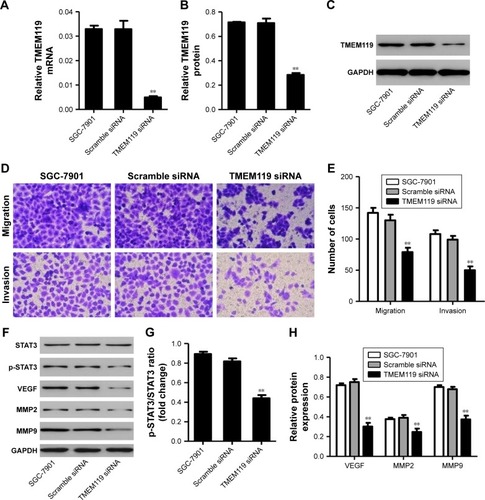 Figure 3 TMEM119 knockdown inhibited SGC-7901 cell migration and invasion. TMEM119 mRNA and protein expression in SGC-7901 cells with TMEM119 siRNA transfection was measured by real-time PCR (A) and Western blotting (B and C). Cell migration and invasion (D and E), and protein expression of STAT3, p-STAT3, VEGF, MMP2, and MMP9 (F–H) in SGC-7901 cells after TMEM119 siRNA transfection was measured by transwell and Western blot analysis, respectively. **P<0.01 compared with scramble siRNA.