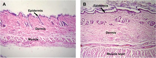 Figure 7 Low intensity photomicrograph of a skin section from (A) a control animal and (B) an animal subcutaneously administered PLA-PEG nanoparticles.Abbreviations: PEG, poly(ethylene glycol); PLA, polylactic acid.