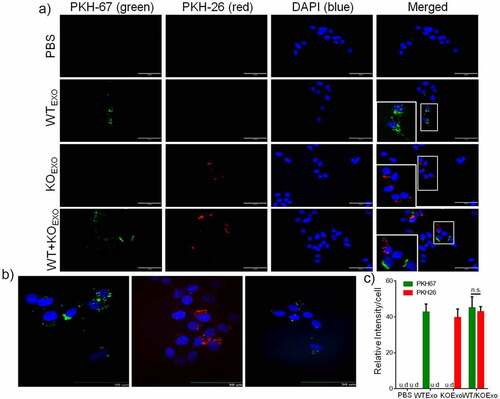 Figure 5. Uptake of HCT116 WT and KO exosomes by BEAS-2B cells. Ten micrograms of PKH67-labeled HCT116 WT exosomes, PKH26-labeled HCT116 HuR KO exosomes or a PKH67/26-PBS control were added per 5 × 104 BEAS-2B cells and incubated at 37°C for 24 hours. Uptake of the fluorescently labeled exosomes by BEAS-2B cells was detected with fluorescence microscopy and confocal microscopy (at 24 hours). (a) Uptake of PKH67/26-PBS control, PKH67-labeled HCT116 WT exosomes (green) and PKH26-labeled HCT116 HuR KO exosomes (red) in BEAS-2B cells at 37°C was evaluated with fluorescence microscopy. Nuclei were stained with DAPI (blue) (scale bar, 100 μm). (b) Uptake of PKH67-labeled HCT116 WT exosomes and PKH26-labeled HCT116 HuR KO exosomes was evaluated with spinning disc confocal microscopy (scale bar, 50 μm). Nuclei were stained with DAPI (blue). (c) Exosomes uptake was quantified by determining the fluorescence intensity, and intensity values are shown as the means ± SEMs (N = 3). The student’s t-test was used to analyze differences between two groups.n.s., no significant difference; u.d., undetected.