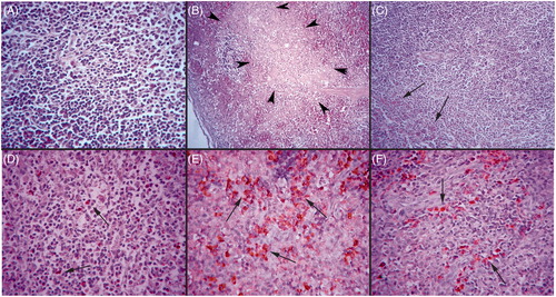 Figure 1. Representative spleen histopathology from rabbits in different groups. (A) A spleen with normal histology in Vit C group, H&E stain; 40 × magnification. Note: Rabbits in the OIL and Vit C groups had similar histologies. (B) A spleen with marked necrosis in END group (arrow heads), H&E stain; 10 × magnification. (C) A spleen with slight lymphocyte depletion in END + C group, H&E stain; 20 × magnification. Representative spleen immunohistochemistry from rabbits in different groups. (D) A spleen with scattered caspase-3+ cells in Vit C group, Streptavidin-biotin peroxidase method; Harris hematoxylin counterstain. 40 × magnification. (E) A spleen with numerous caspase-3 immunoreactions (indicating significant apoptosis) among cells in rabbits in the END groups. Streptavidin-biotin peroxidase method; Harris hematoxylin counter stain. 40 × magnification. (F) A spleen with a slight degree of caspase-3 immunoreactions indicating a decrease in apoptosis among cells present in the END + C group, Streptavidin-biotin peroxidase method; Harris hematoxylin counterstain. 40 × magnification.