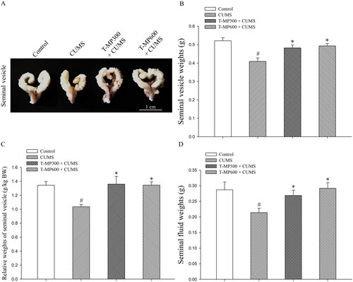 Figure 1. Representative photographs showing the (A) gross morphology, (B) absolute and (C) relative weights of the mouse seminal vesicles, and (D) fluid as compared among control, CUMS, and co-treated groups after co-treatment for 57 consecutive days (n = 12, each group). #p < 0.05, statistically significant difference as compared between the control and CUMS groups. *p < 0.05, statistically significant difference as compared between the CUMS and co-treated groups.