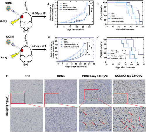 Figure 4 Radiation sensitization effect of GONs in vivo. Tumor growth curve (A) and survival curve (B) of mice in fractionated 8.0 Gy irradiation experiment. Tumor growth curve (C) and survival curve (D) of mice in fractionated 3.0 Gy*3 irradiation experiment. Data quantifications were analyzed using a Student’s t-test (A and C) or a Log-rank (Mantel-Cox) test (95% CI) (B and D) and expressed as mean ± s.e.m, *p < 0.05, **p < 0.01, ***p < 0.001, ns means not significant. (E) Tunel staining of tumors in the different treatment groups. All the scale bars in the figure are 100 μm. The red arrows point to cells that are Tunel-positive for apoptosis.