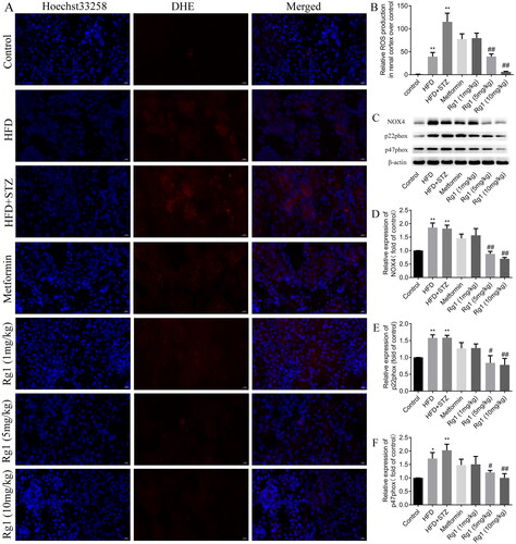 Figure 7. Effect of Rg1 treatment on oxidative stress in the renal cortex of T2DM mice. (A) The results of ROS production in the renal cortex (DHE staining, ×400). (B) The mean density of ROS fluorescence in the renal cortex. (C) The bands of NOX4, p22phox, p47phox, and β-actin (Western blotting). (D) The relative expression of NOX4 over control. (E) The relative expression of p22phox over control. (F) The relative expression of p47phox over control. The data are expressed as the mean ± SD, ROS, n = 3, Western Blot, n = 4, **p< 0.05 compared with the control group; #p< 0.05, ##p< 0.01 compared with the HFD + STZ group.