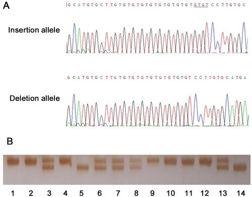 Figure 3. Examples of sequencing and genotyping output of rs3833144.(A) The sequencing output of insertion and deletion allele of rs3833144. The underlined bases are the “GTGT” insertion in coding strands. (B) The examples of the genotyping results. The amplified DNA fragments were analyzed by 7% non-denaturing polyacrylamide gel electrophoresis and silver staining (lane 3, 6, 7, 8 and 13, ins/del genotype; lane 5 and 14, del/del genotype; remaining lanes, ins/ins genotype