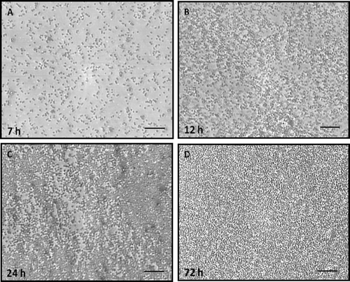 Figure 3. Microphotograph taken using a camera attached to an inverted microscope of the kinetics of biofilm formation by H. capsulatum in polystyrene microtiter plates after aspiration of BHI medium and subsequent washings with PBS, as determined by the colorimetric XTT reduction assay. The average of three XTT assay measurements was taken. This experiment was performed twice, with similar results each time. Bars = 100 μm for panels A, B, C, and D.