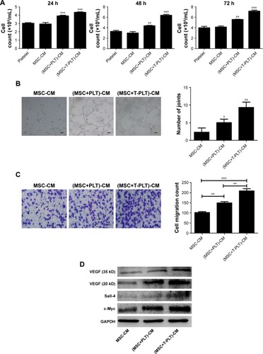 Figure 4 Platelets enhanced the effect of BM-MSCs on proliferation and metastasis of tumor cells.