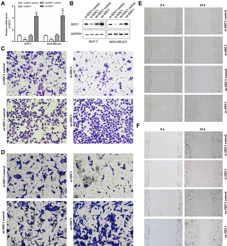 Figure 7 Effects of SDC1 knockdown or overexpression on BC cells’ invasion and migration. (A) Quantitative PCR analysis of SDC1 expression levels in si-SDC1 control, si-SDC1, oe-SDC1 control and oe-SDC1 breast cancer cell lines (MCF-7 and MDA-MB-231). (B) Western blot of SDC1 expression levels in si-SDC1 control, si-SDC1, oe-SDC1 control and oe-SDC1 breast cancer cell lines (MCF-7 and MDA-MB-231). (C) Effects of SDC1 knockdown or overexpressed on invasion of MDA-MB-231 breast cancer cells. (D) Effects of SDC1 knockdown or overexpressed on invasion of MCF-7 breast cancer cells. (E) Effects of SDC1 knockdown or overexpressed on migration of MDA-MB-231 breast cancer cells showed by scratch assays. (F) Effects of SDC1 knockdown or overexpressed on migration of MCF-7 breast cancer cells showed by scratch assays. ***:P < 0.001.