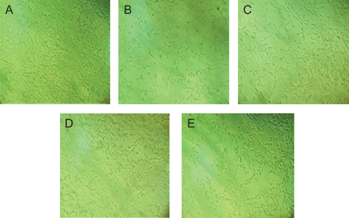 Figure 3.  PC12 cells were observed by inverted microscope (100×). Cells were treated with H2O2 in the absence or in the presence of oleanolic acid except for the control group. (A) Control conditions. (B) After exposure to 300 μM H2O2 for 2 h. (C to E) Cells were pretreated with oleanolic acid for 1 h at 10, 1, 0.1 μM before exposure to H2O2.