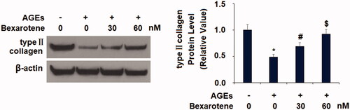 Figure 6. Bexarotene inhibits AGE-induced loss of type II collagen. Protein levels of type II collagen were measured (*, p < .01 vs. vehicle group; #, p < .01 vs. AGE group; $, p < .01 vs. AGE + 30 nM bexarotene, n = 5–6).