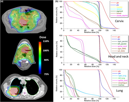 Figure 3. Overview of DPBN dose distribution in an axial slice for all three test cases (a). OAR and target volume DVHs for the cervix, head and neck and lung case with DPBN plans (solid lines) compared to corresponding standard homogeneous plans (dotted lines) (b).