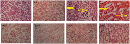 Figure 3. Photomicrographs at 100 magnification of the control group; C–A: cortex presenting no major defect, C-B: medulla presenting normal tubules. The gentamicin-treated group, G-A: cortex presenting proximal tubular necrosis, glomerular atropy, G-B: medulla presenting ruptured tubules. Co-therapy of gentamicin and M. alba, GMal-A: cortex presenting dilated proximal tubules with few ruptured cells, GMal-B: medulla presenting hazy façade with regenerative activities. The M. alba-treated group, Mal-A: cortex presenting ordinary glomeruli with usual tubular façade, Mal-B: medulla presenting normal tubules with a some hyaline-packed lumina.