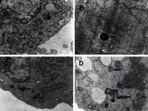 Figure 5 Electron microscopic results of BEZ235-induced autophagy in KBM7R cells (A panel is the control group, B panel is 1 μM for 12 h group, C panel is 1 μM for 24 h group, and D panel is for 5 μM for 24 h group, the arrows point to the autophogosomes).