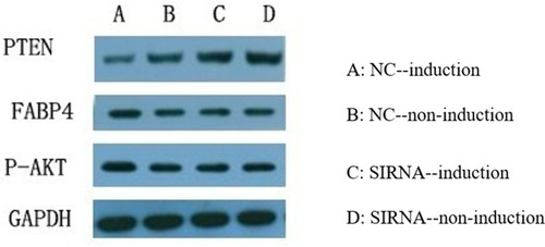 Figure 5 The protein expression levels of A-FABP, p-AKT and PTEN after inhibition of A-FABP or induction with insulin.