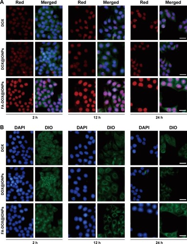 Figure 4 MCF-7 cells incubated with free DOX, DOX@IONPs, and FA-DOX@IONPs (at equivalent DOX concentration of 7.5 μg/mL). (A) DOX fluorescence is red (in the left panel), cell nuclei were stained with blue using DAPI, and the membranes and cytoplasm were stained with green using DIO. Merged images are shown in the right panel. (B) Fluorescence images with only DAPI and DIO staining. Scale bars =20 μm.Abbreviations: DOX, doxorubicin; FA, folic acid; IONP, iron oxide nanoparticle; DIO, 3,3′-dioctadecyloxacarbocyanine perchlorate; DAPI, 4′,6-diamidino-2-phenylindole.